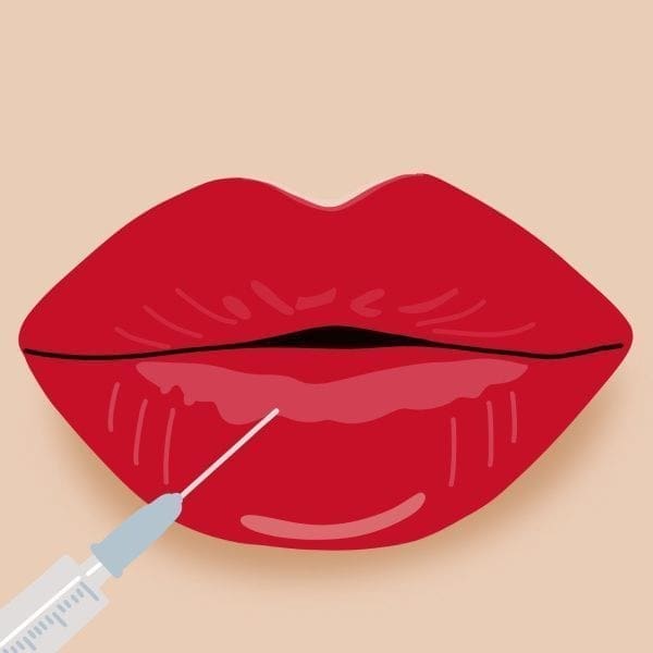 What Are Dermal Fillers And Are They Better Than Cosmetic Surgery?