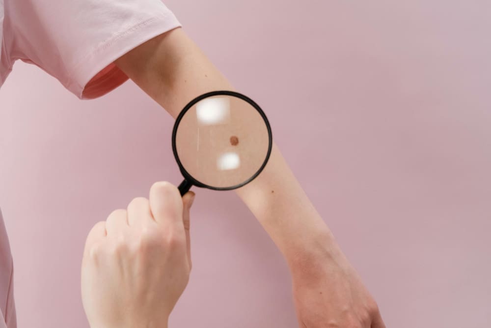 mole under magnifying glass